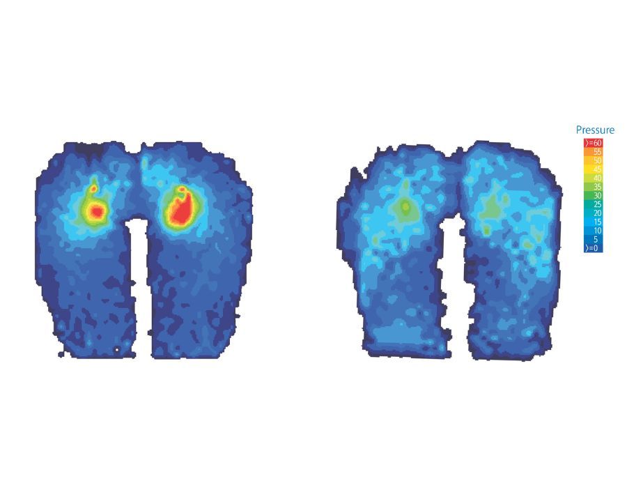 Pressure Mapping And Correct Seating